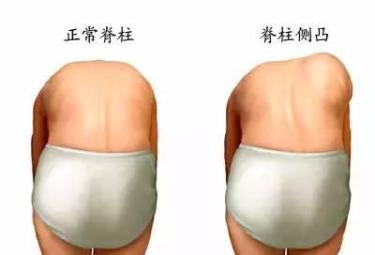 寶寶身高原來與脊椎發(fā)育有關(guān),有些動作要注意！