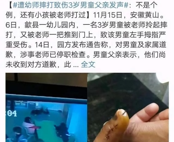 得知孩子被虐待，寶爸怒打幼師，園方袒護老師不道歉不讓報警