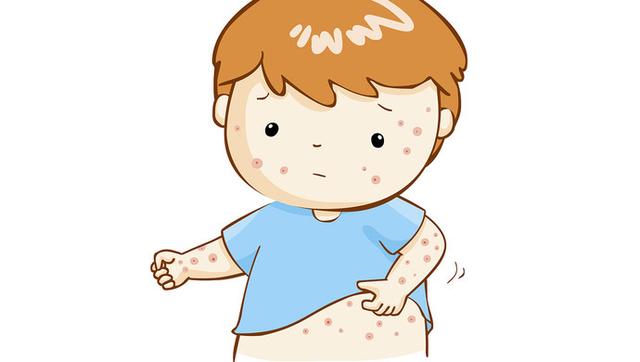 伏天皮膚科“一號疾病”易高發(fā)，孩子中招了怎么辦？